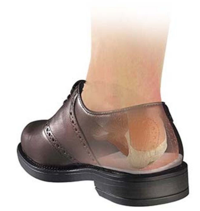 Medial/Lateral Heel Pads