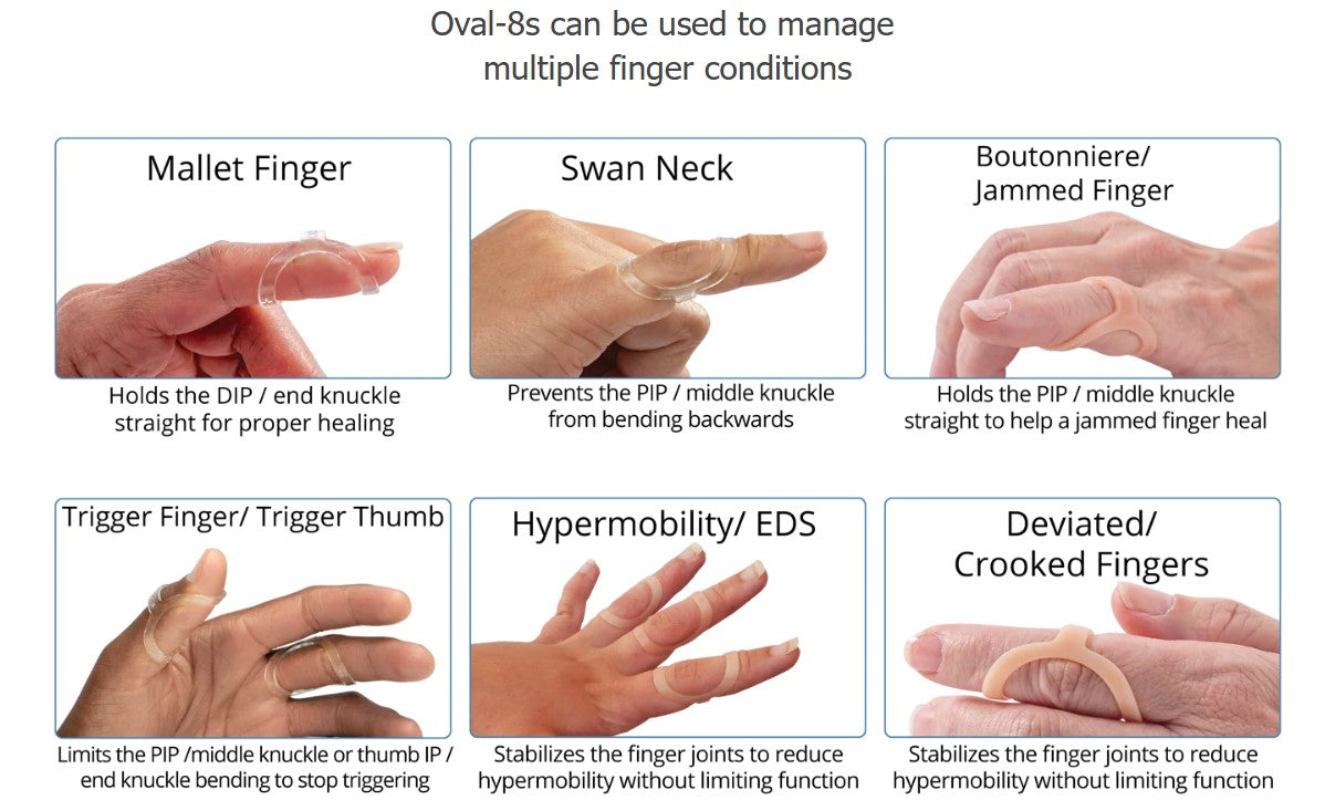 Oval-8 Beige Finger Splints