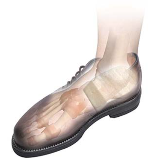 Heel Lifts